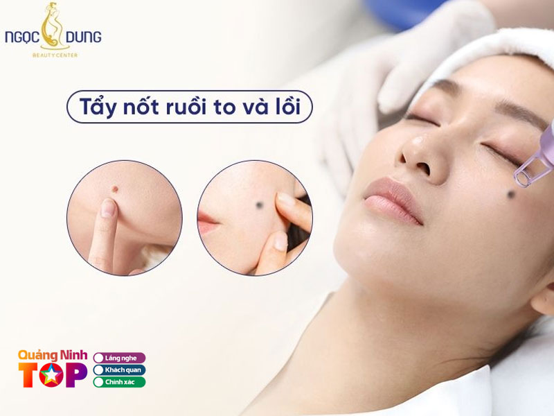 Tham-my-vien-ngoc-dung-quangninhtoplist