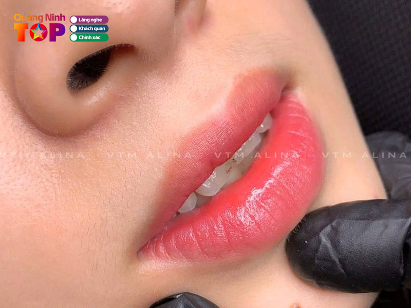 Vien-tham-my-alina-quangninhtoplist